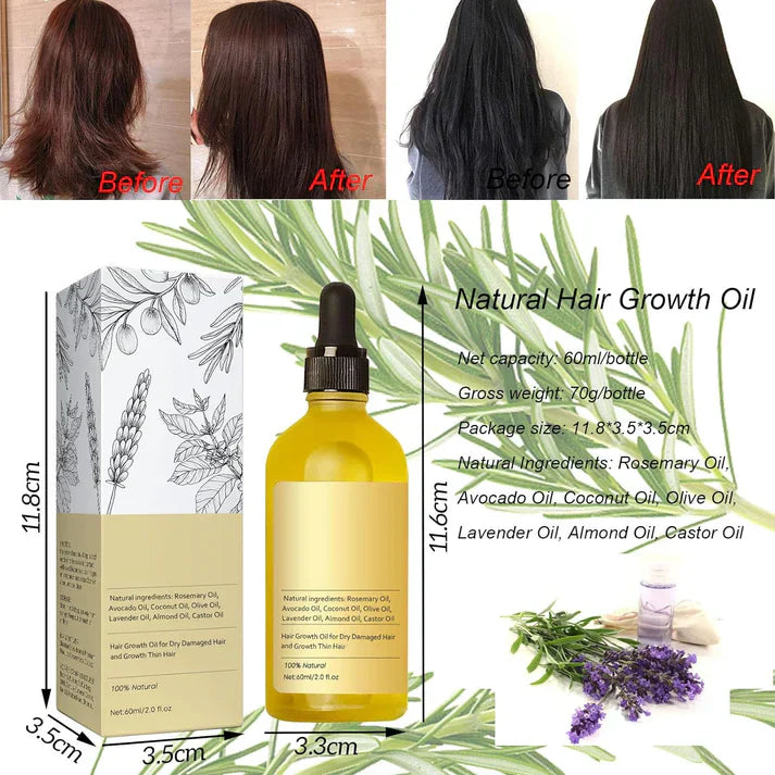 Veganic Natural Hair Growth Oil - (Buy 1 Get 1 Free🔥) - LIMITED STOCK BUY NOW !!
