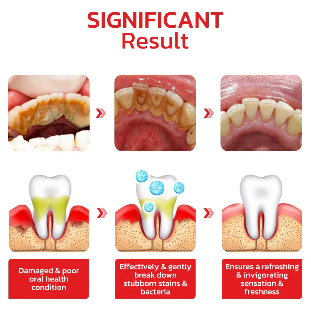 BrightenUp™ - SP-4 Ultra+ Teeth Whitening Toothpaste ✨🦷