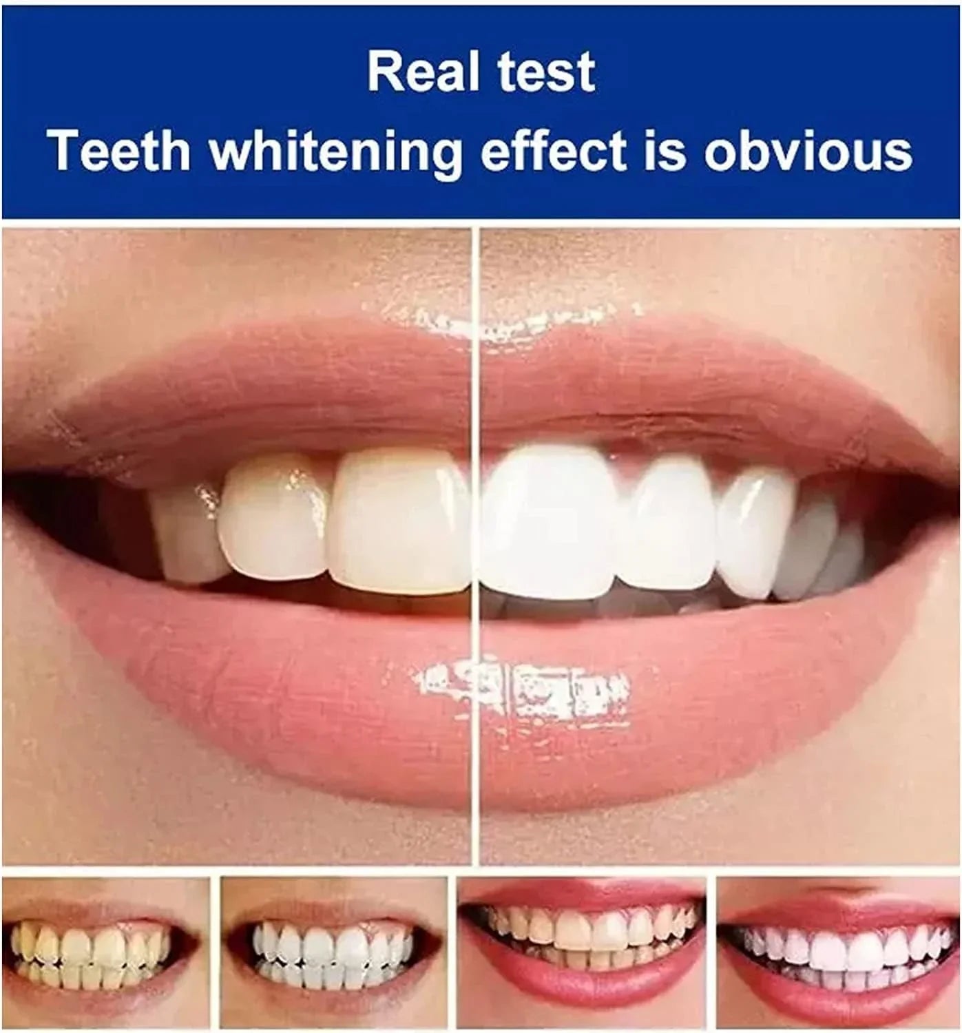 BrightenUp™ - SP-4 Ultra+ Teeth Whitening Toothpaste ✨🦷