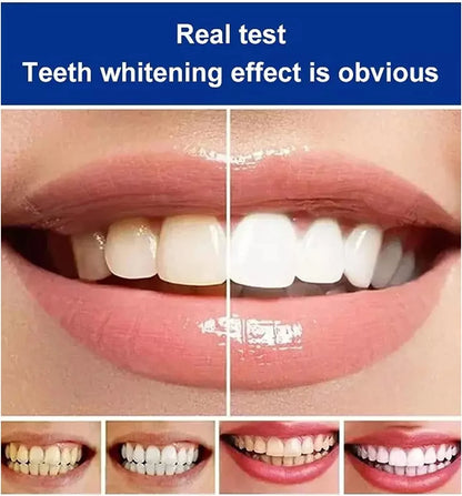BrightenUp™ - SP-4 Ultra+ Teeth Whitening Toothpaste ✨🦷