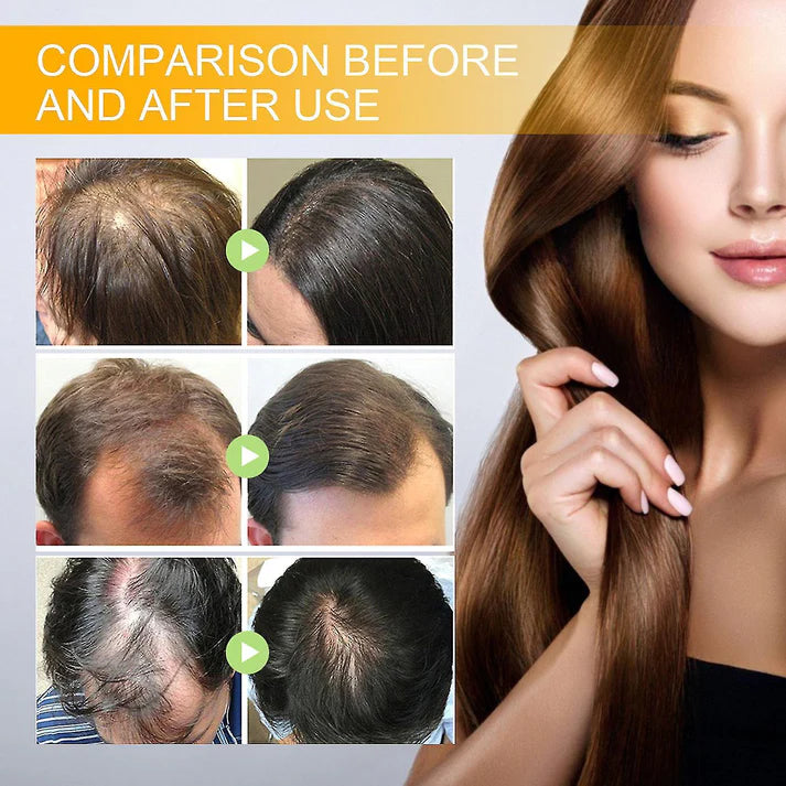 10x™ Rapid Hair Growth Spray - Hair growth in 30 days Guarantee [Buy 1 Get 1 Free🔥]