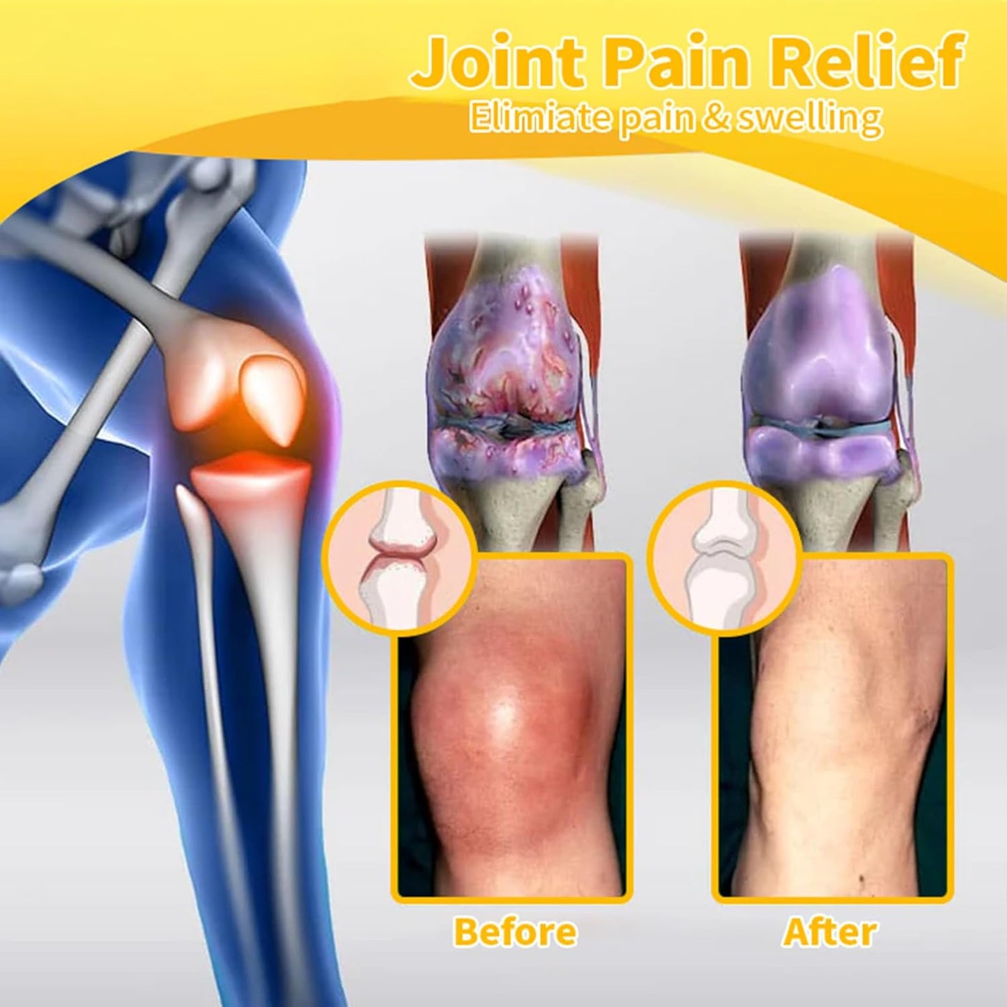BeeFlex™ - Bee-Venom Pain-Relief Bone Healing Cream 🐝✨(Buy 1 Get 1 Free🔥🔥)