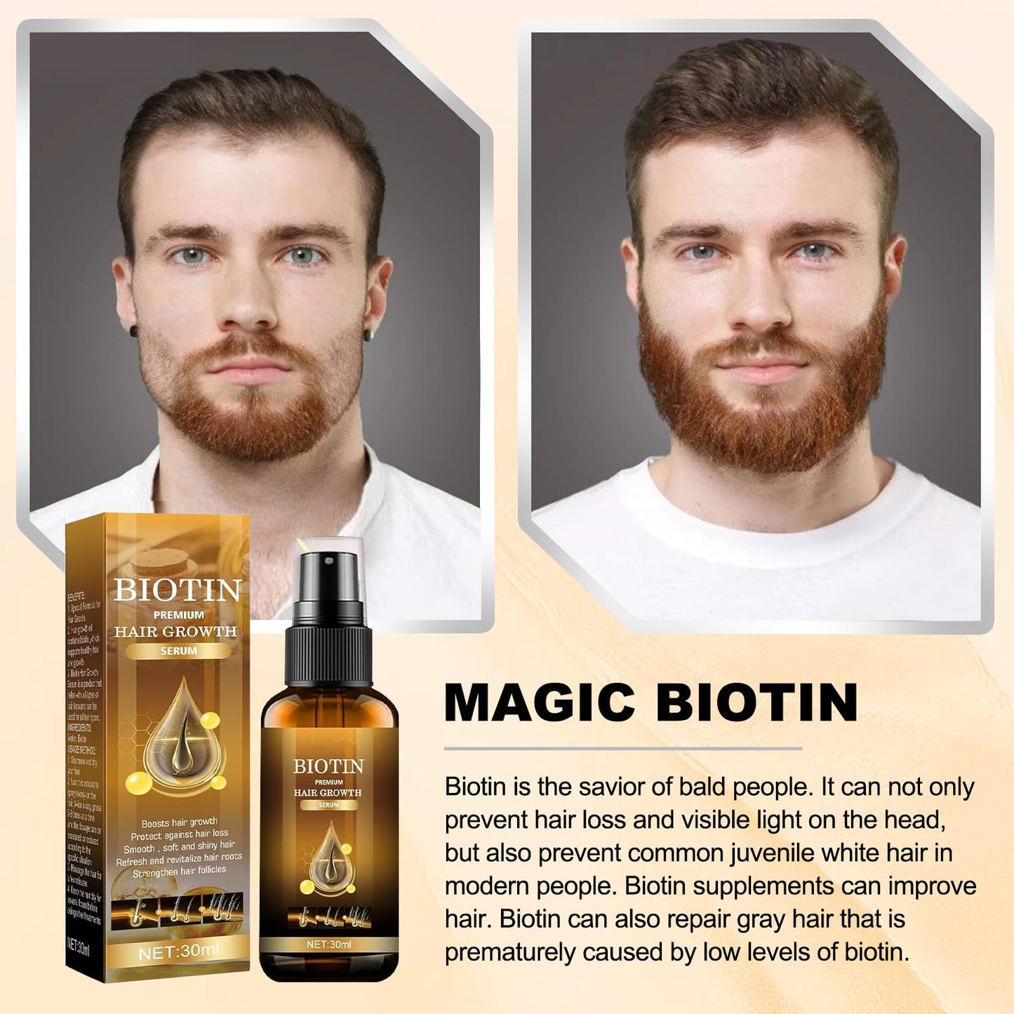 10x™ Rapid Hair Growth Spray - Hair growth in 30 days Guarantee [Buy 1 Get 1 Free🔥]