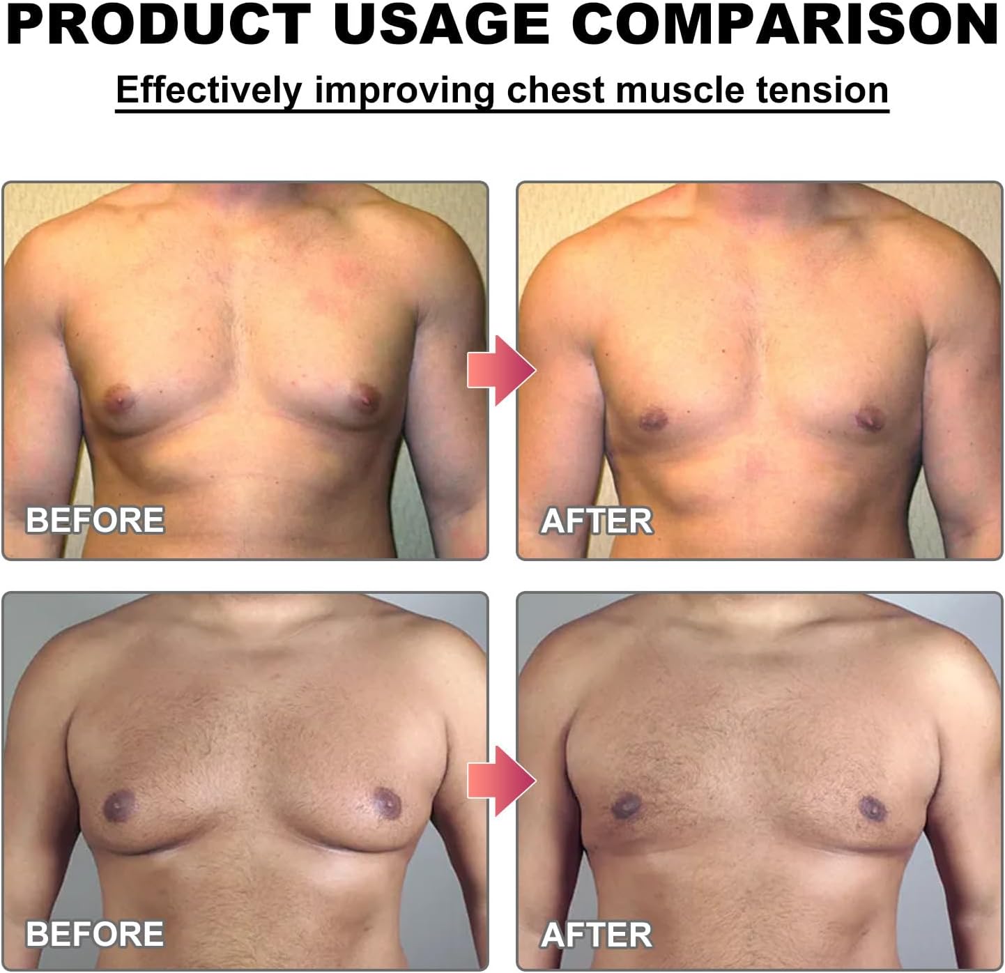 Bee Venom Gynecomastia Heating Oil (Reduce Chest Fat in 30 Days) - Buy 1 Get 1 Free🔥