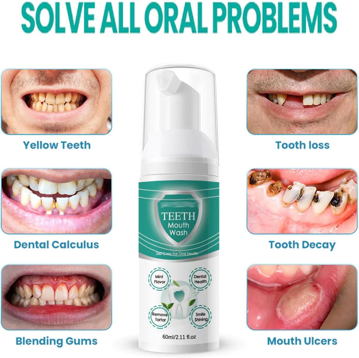 TeethPro™ Instant Whitening Foam Wash (Buy 1 Get 1 Free🔥) - LIMITED STOCK