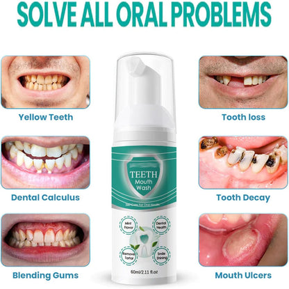TeethPro™ Instant Whitening Foam Wash (Buy 1 Get 1 Free🔥) - LIMITED STOCK
