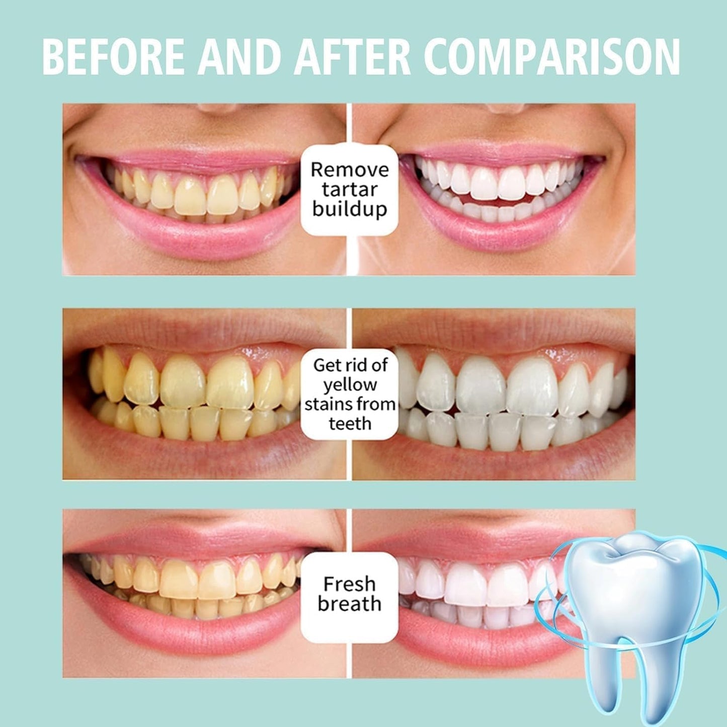 TeethPro™ Instant Whitening Foam Wash (Buy 1 Get 1 Free🔥) - LIMITED STOCK